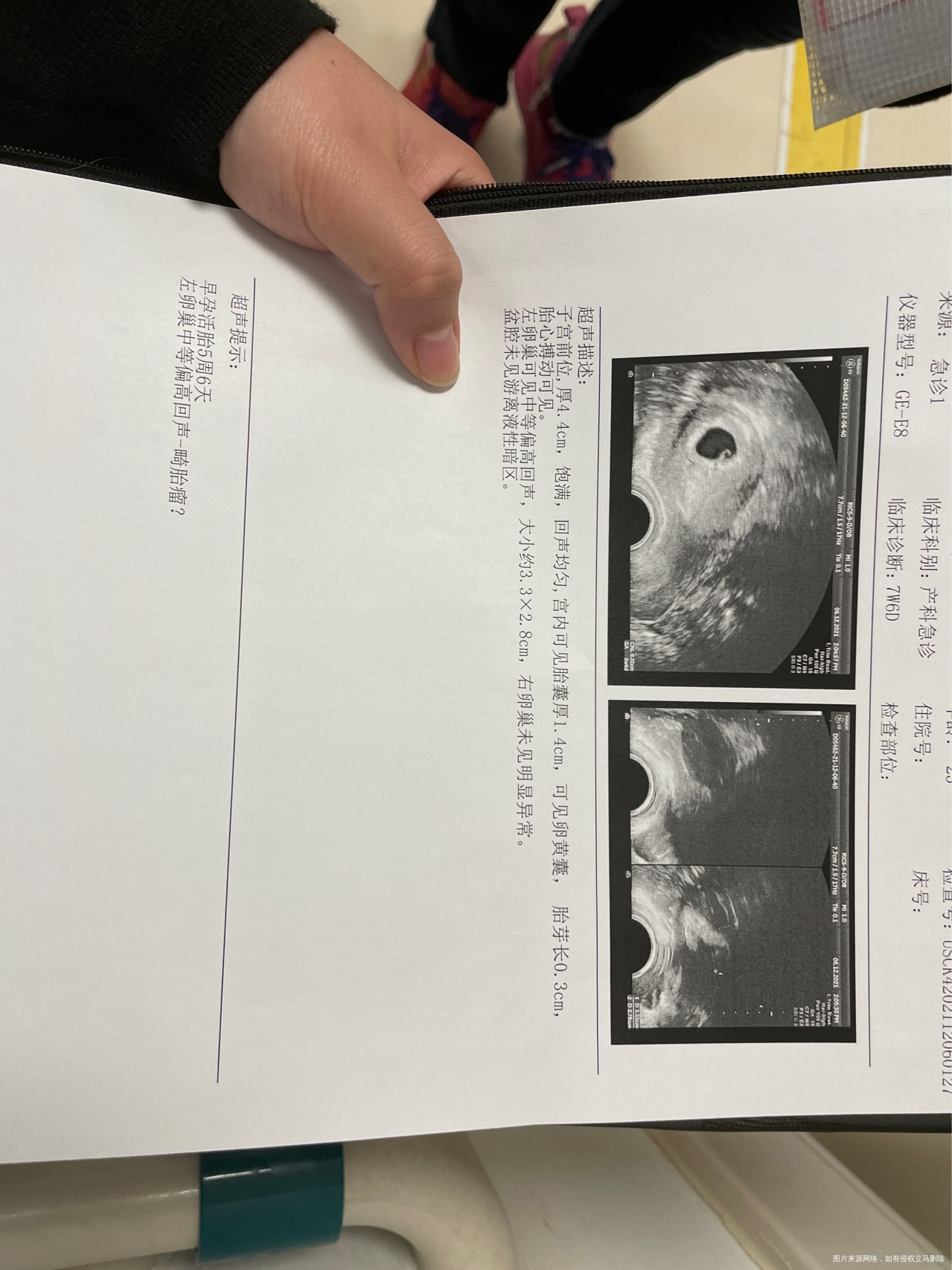 末次月经1012号每次月经3440天来一次发