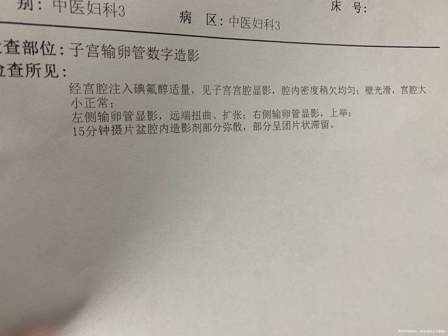 你好这个是怎么治疗呢宫腔镜结扎还是其他方法呢