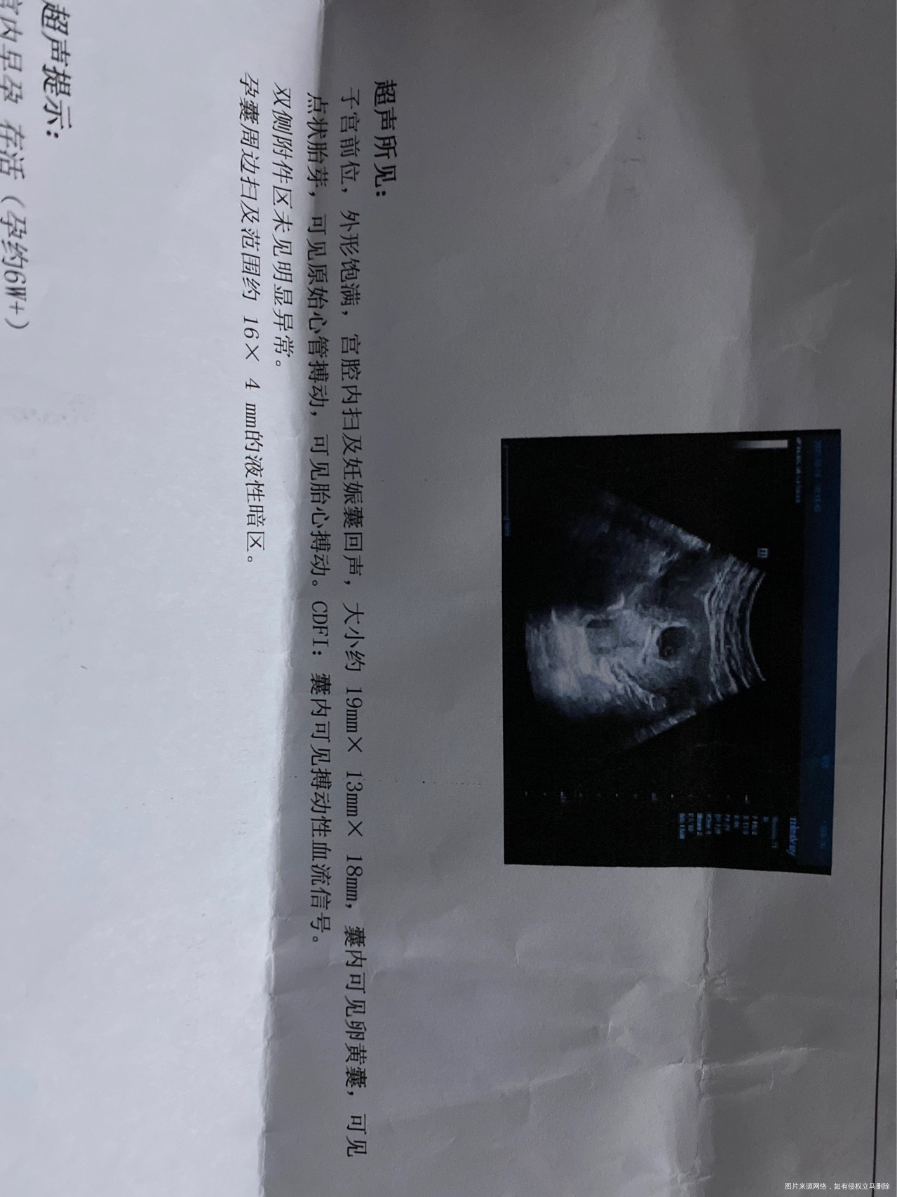 这个好还是不好呢夜性暗区是什么意思