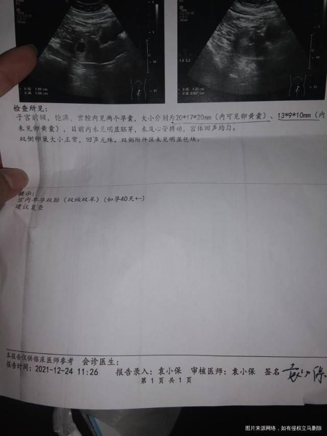 第一张是18的第二张今天的上次两个都有卵黄囊