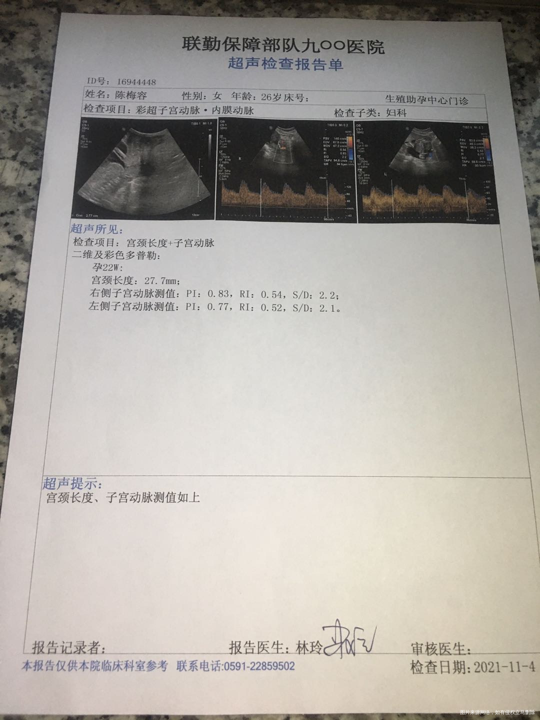 这是我今天的彩超帮我看看报告有木有问题然后今