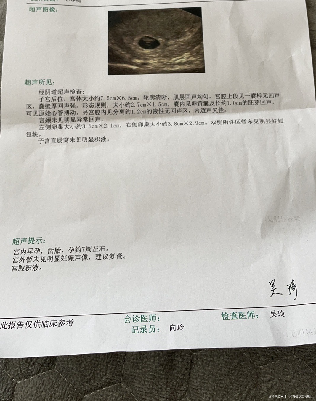 请问一下宫颈积液影响大吗