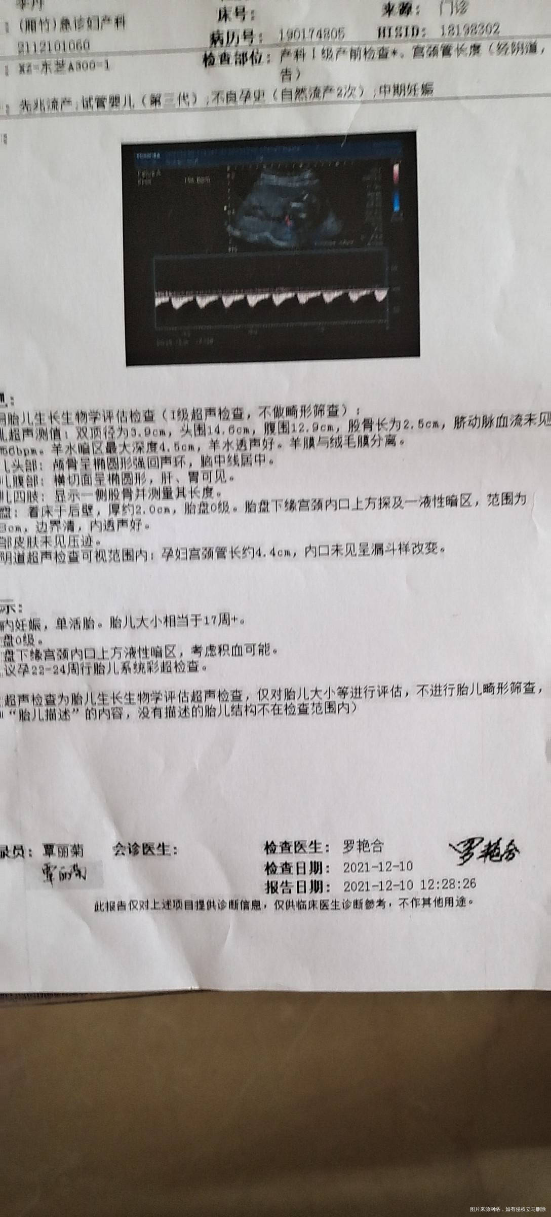 医生7号做了羊水穿刺下体一直有少量液体流出昨