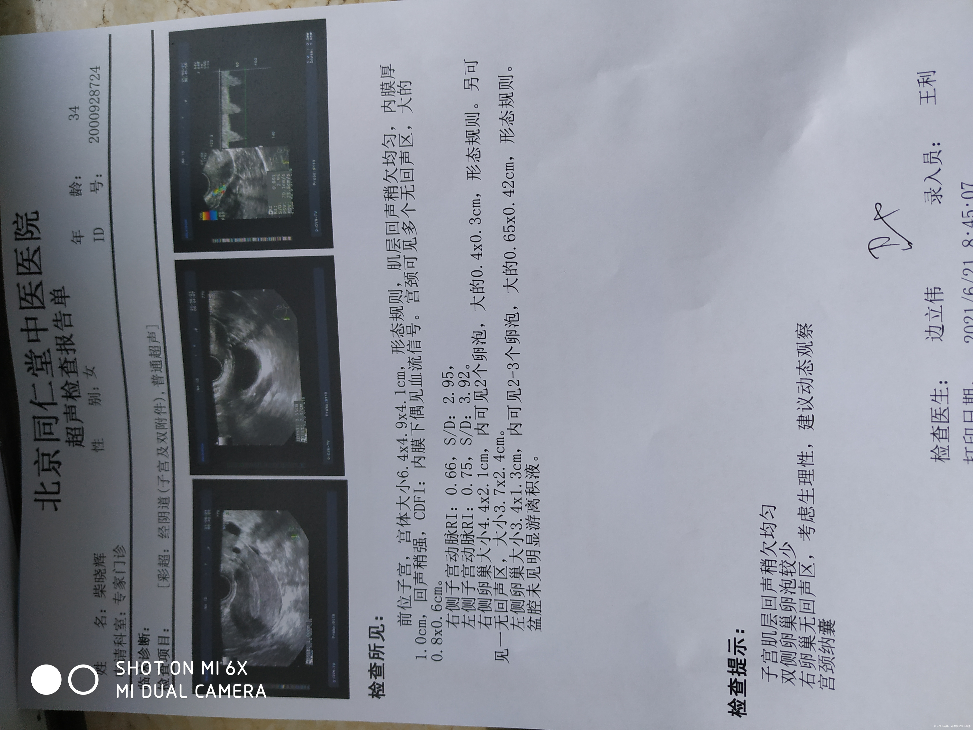 您好我是不喝黄体酮自己来不了月经也不排卵卵巢