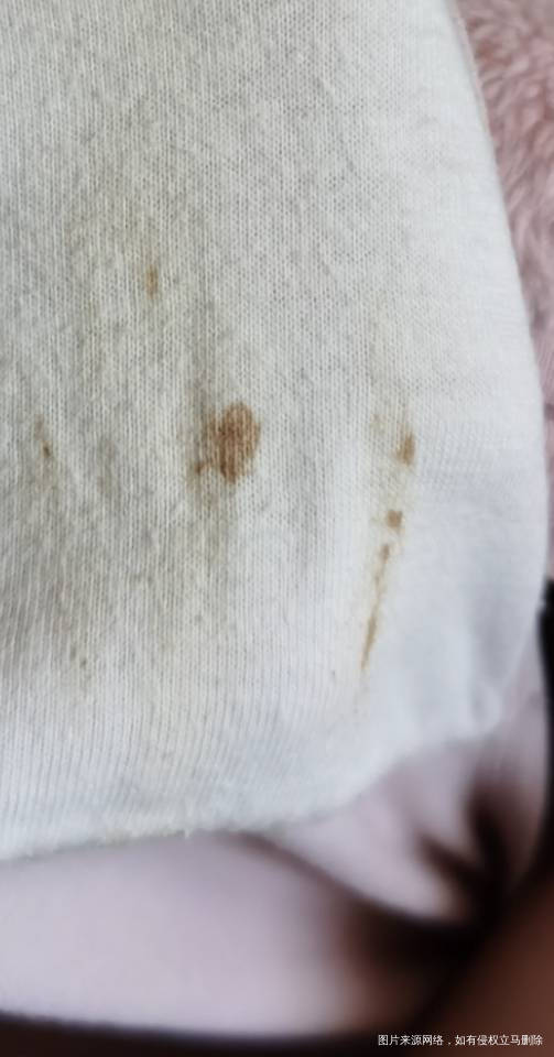 怀孕16周+5有褐色血在内裤上但是不多肚子涨