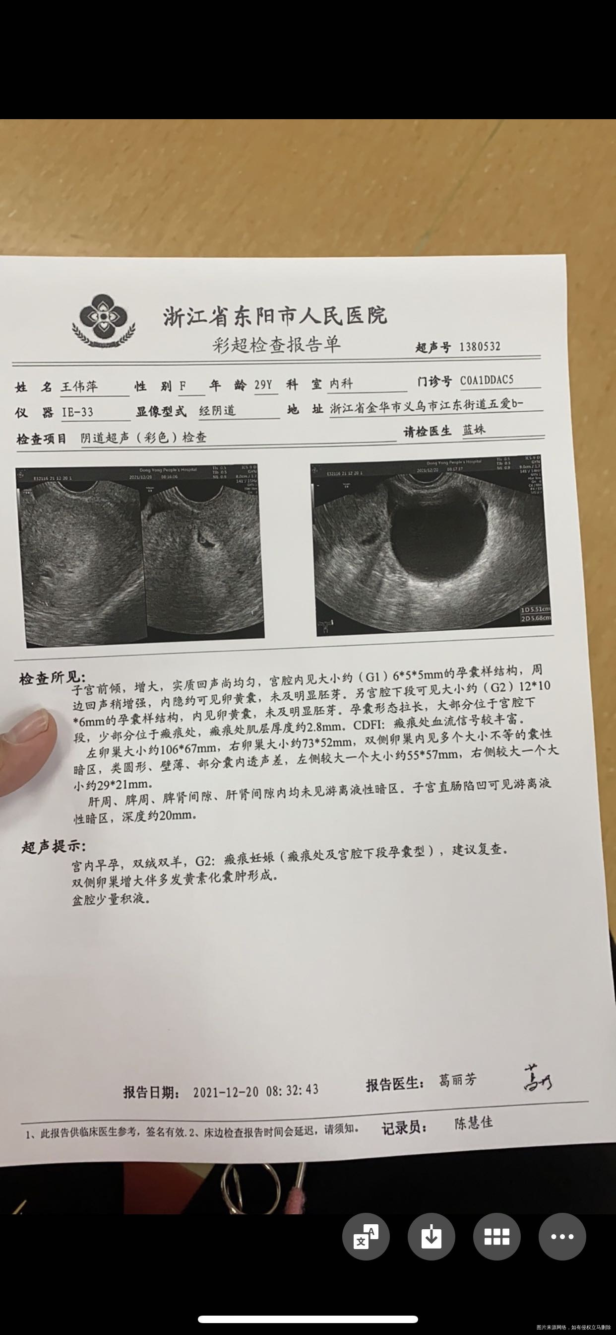 这个情况能怎么办能不能把刀疤上那个减掉留小的