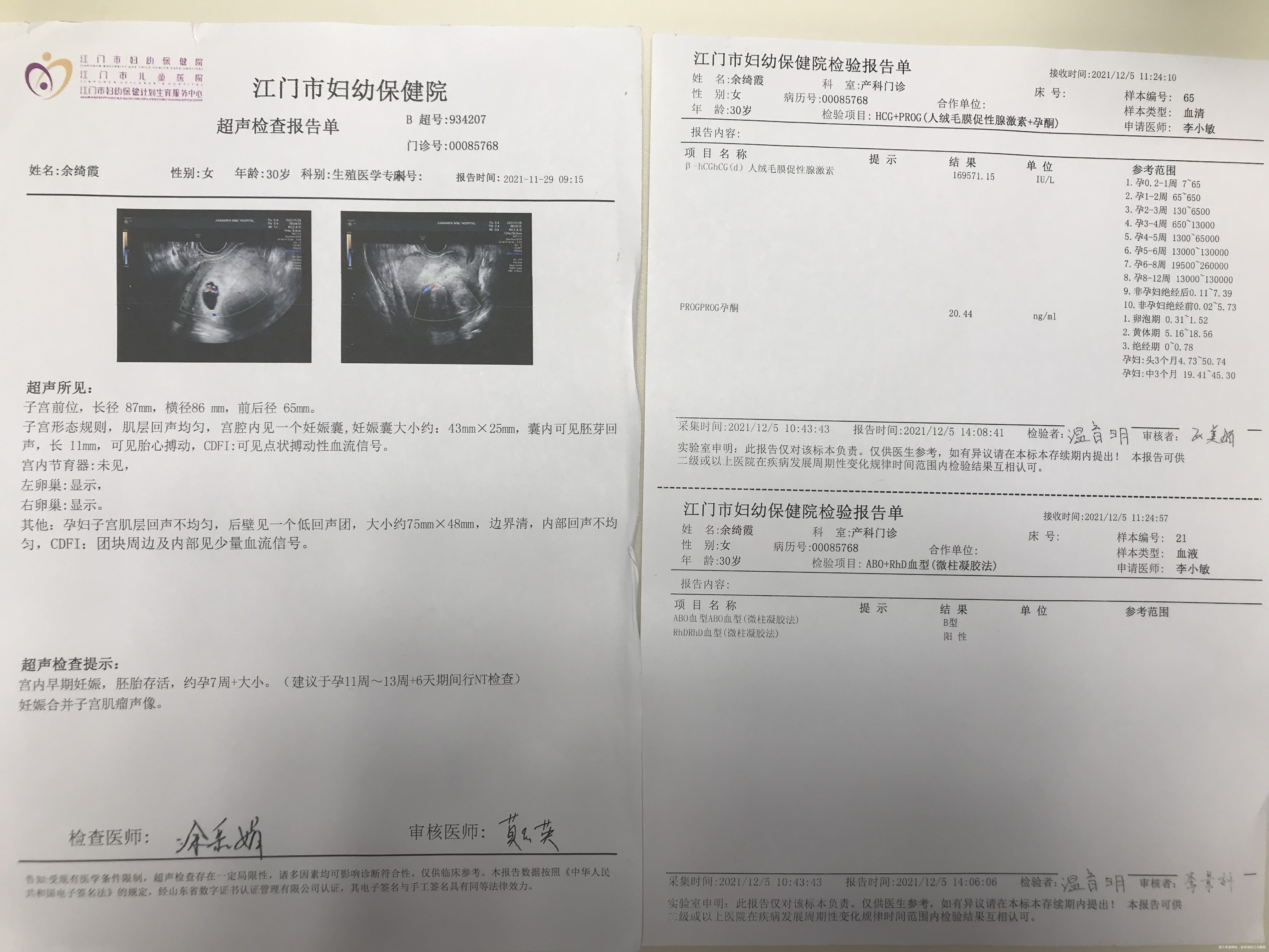 末次月经10月10号孕5周开始断断续续有褐色