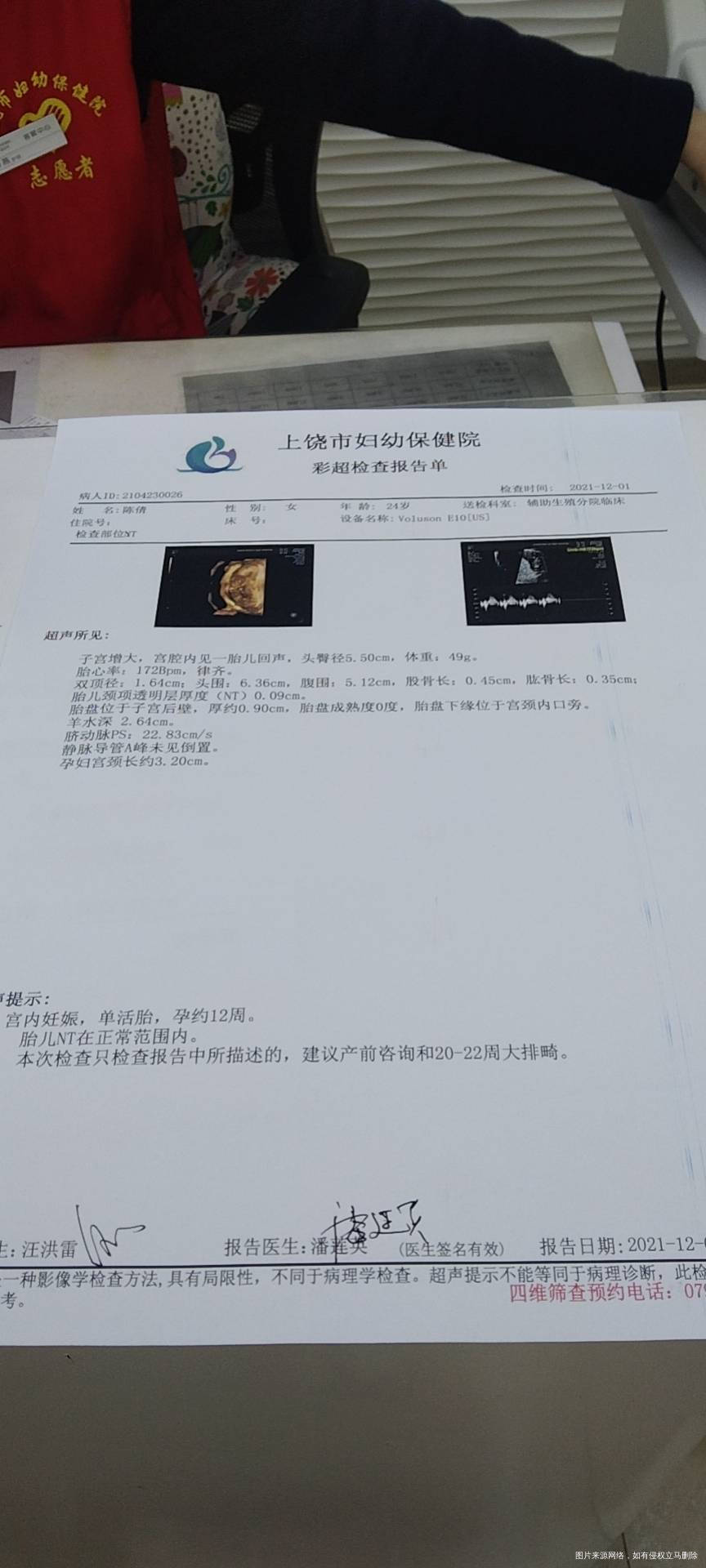 医生我这个胎盘会低吗