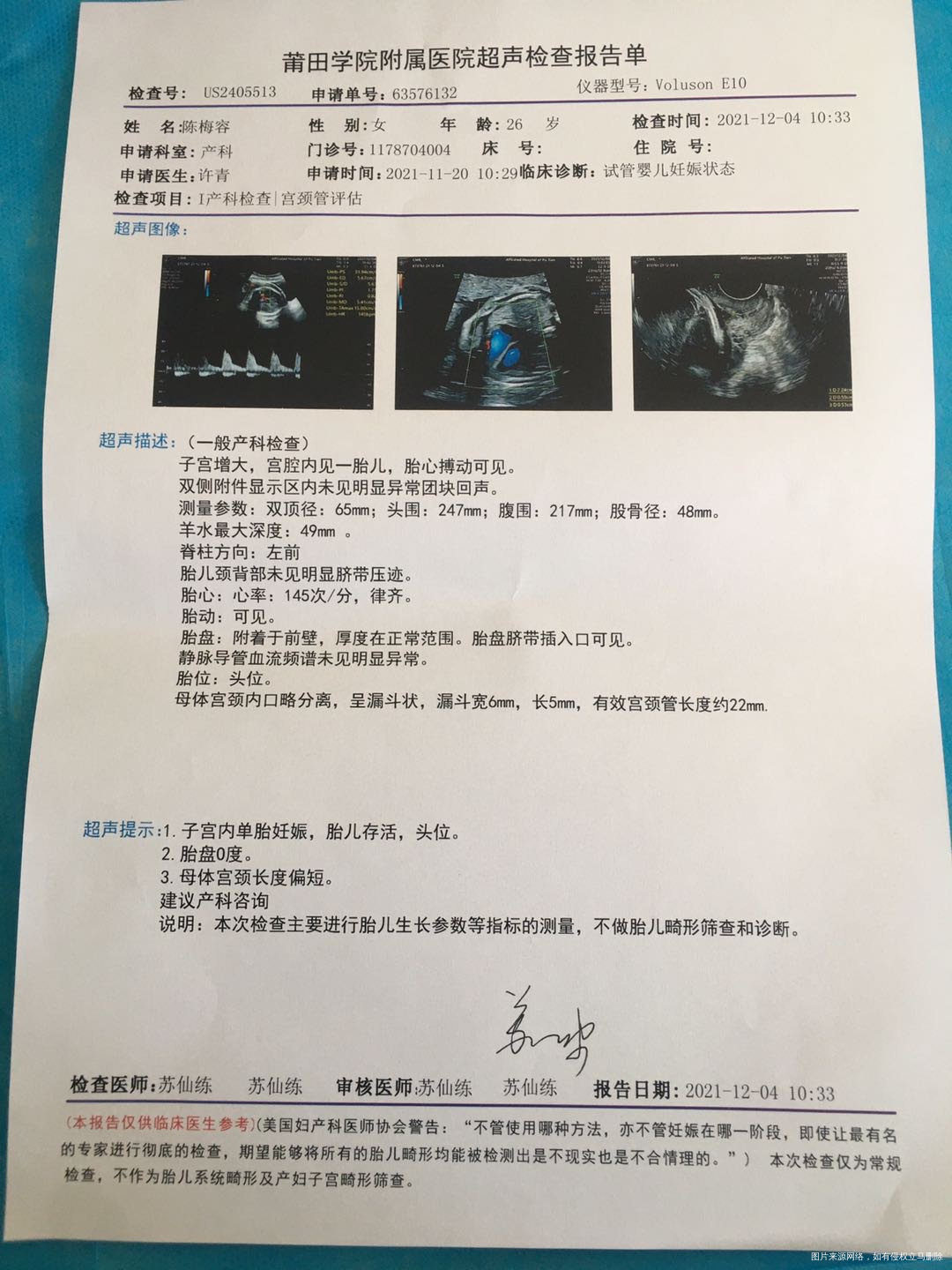 你好医生9号做的环扎手术昨天20号去复查彩超