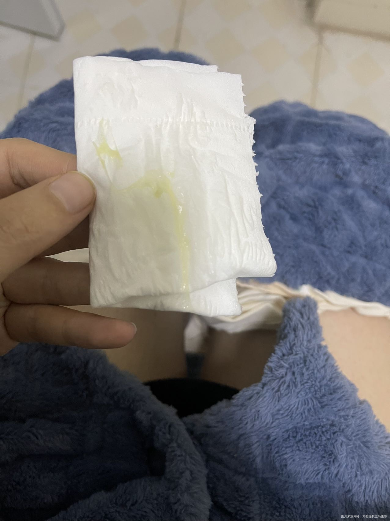 不好意思图片有点恶心想咨询一下医生现在孕16