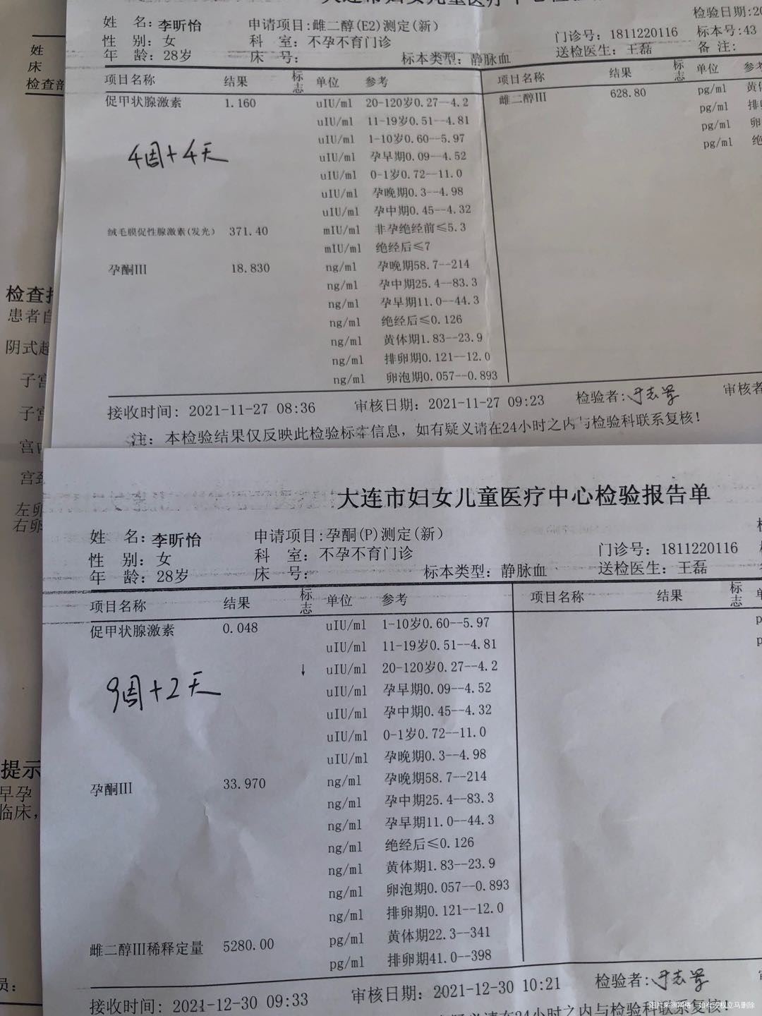 因多囊综合症做试管现已怀孕单胎孕9周+3天无