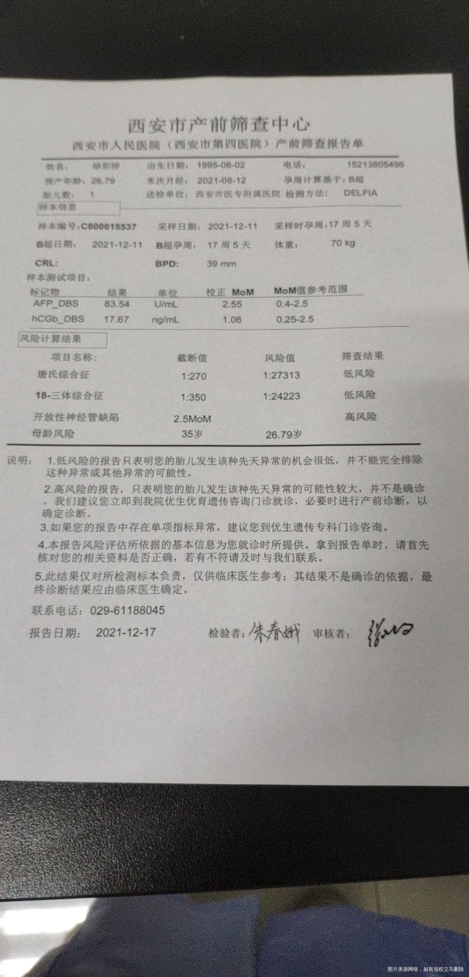 唐筛一项高风险严重不