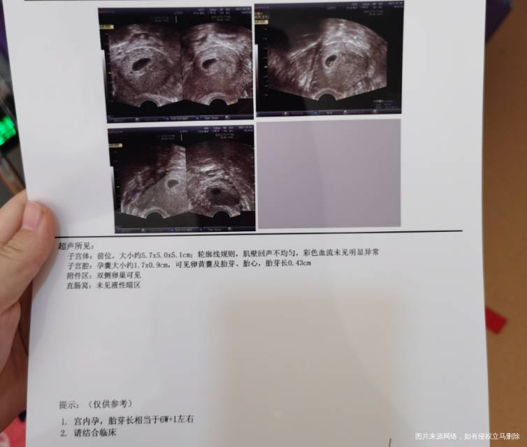 12月14号hcg值1178944miu/m