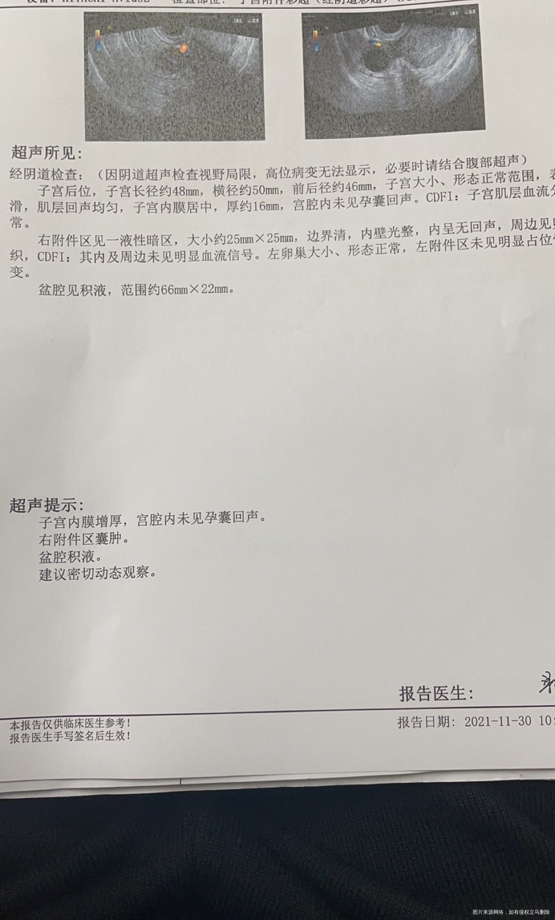 末次月经10月20号到26排卵日11月11跟