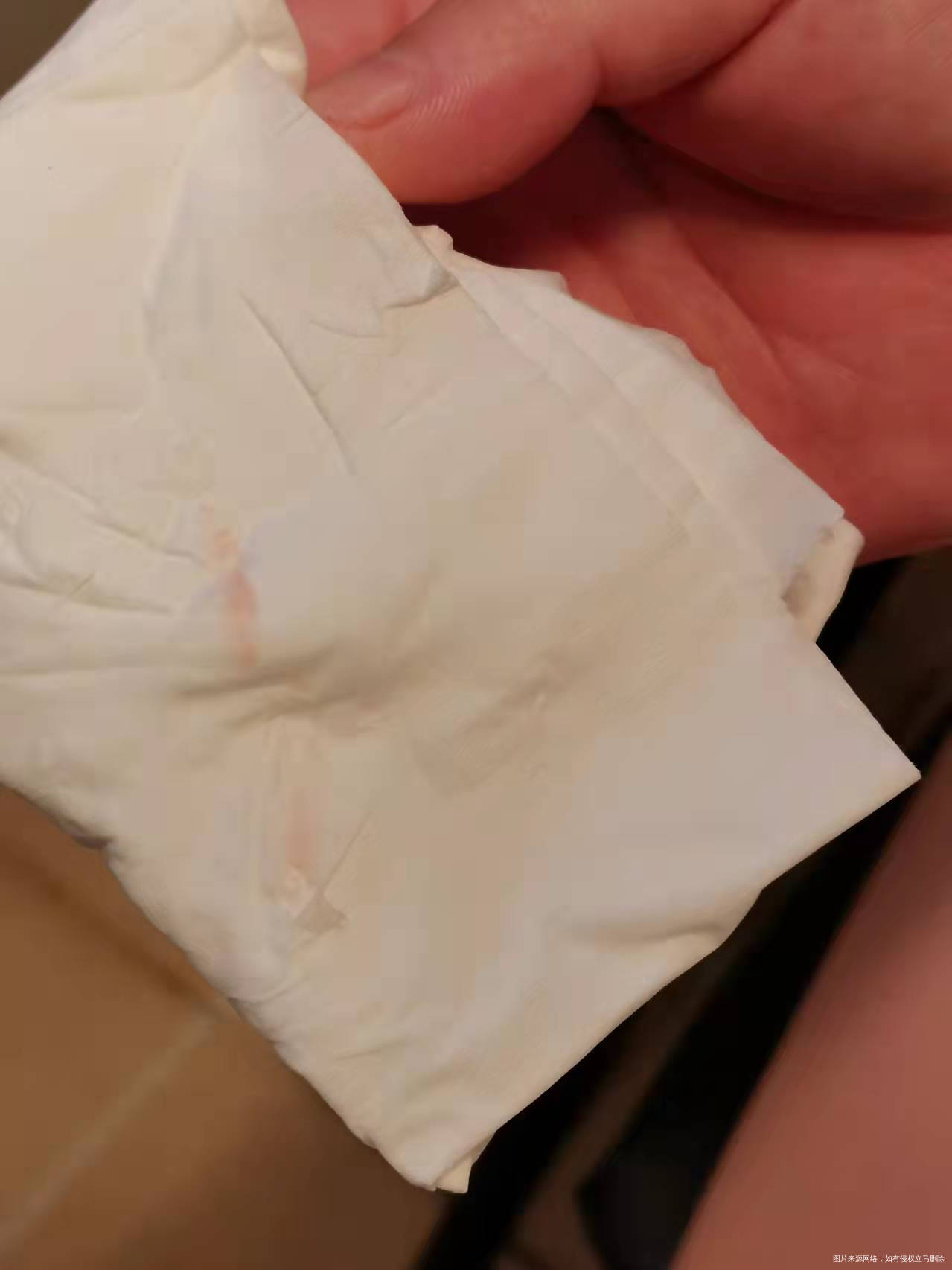 孕13周做了宫颈环扎现孕24周今天小便完擦拭