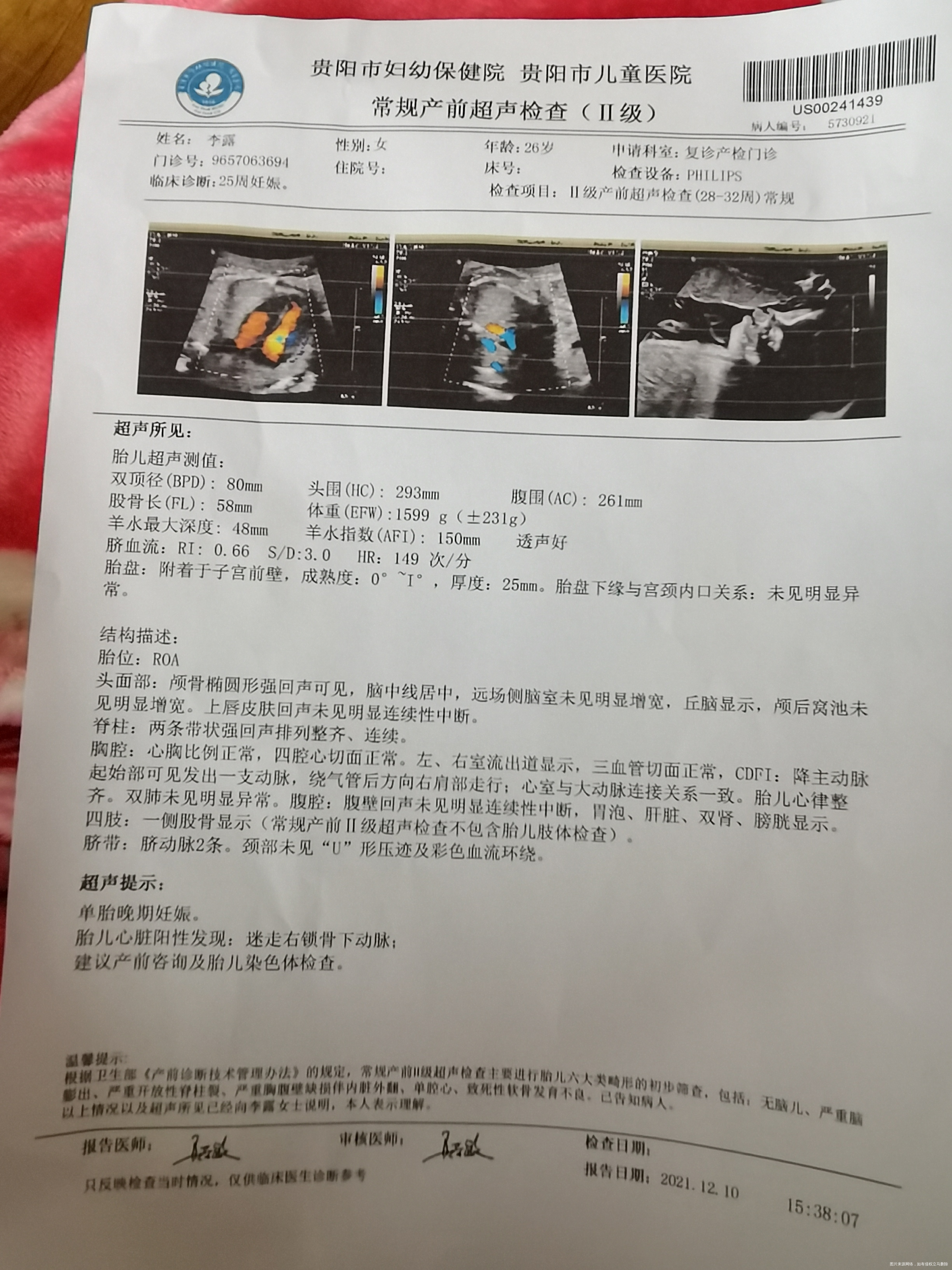 胎儿迷走右锁骨下动脉没有做羊水穿刺和无创DN