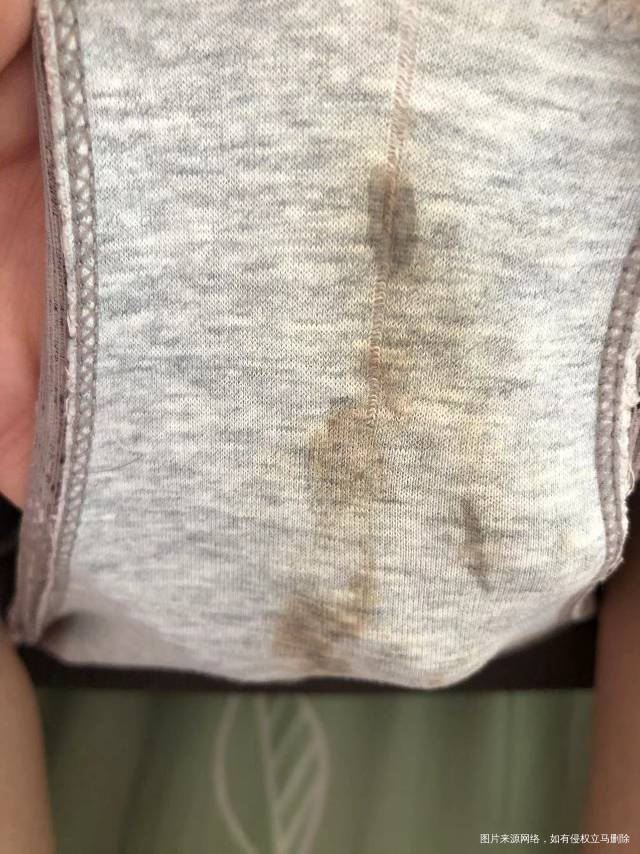 冻囊胚移植第22天阴道有分泌物