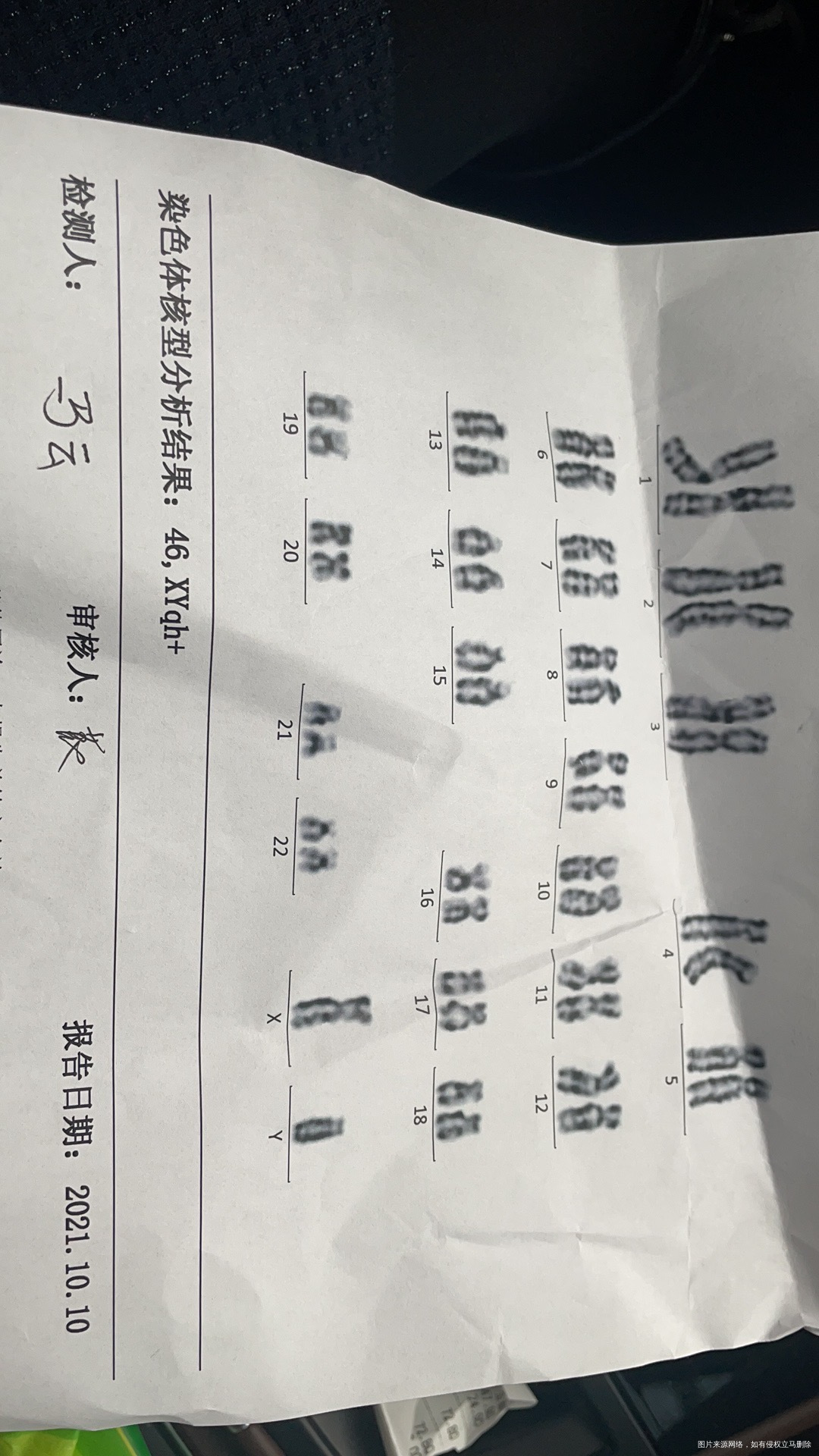 男性染色体异常这个情况对下一代有什么影响