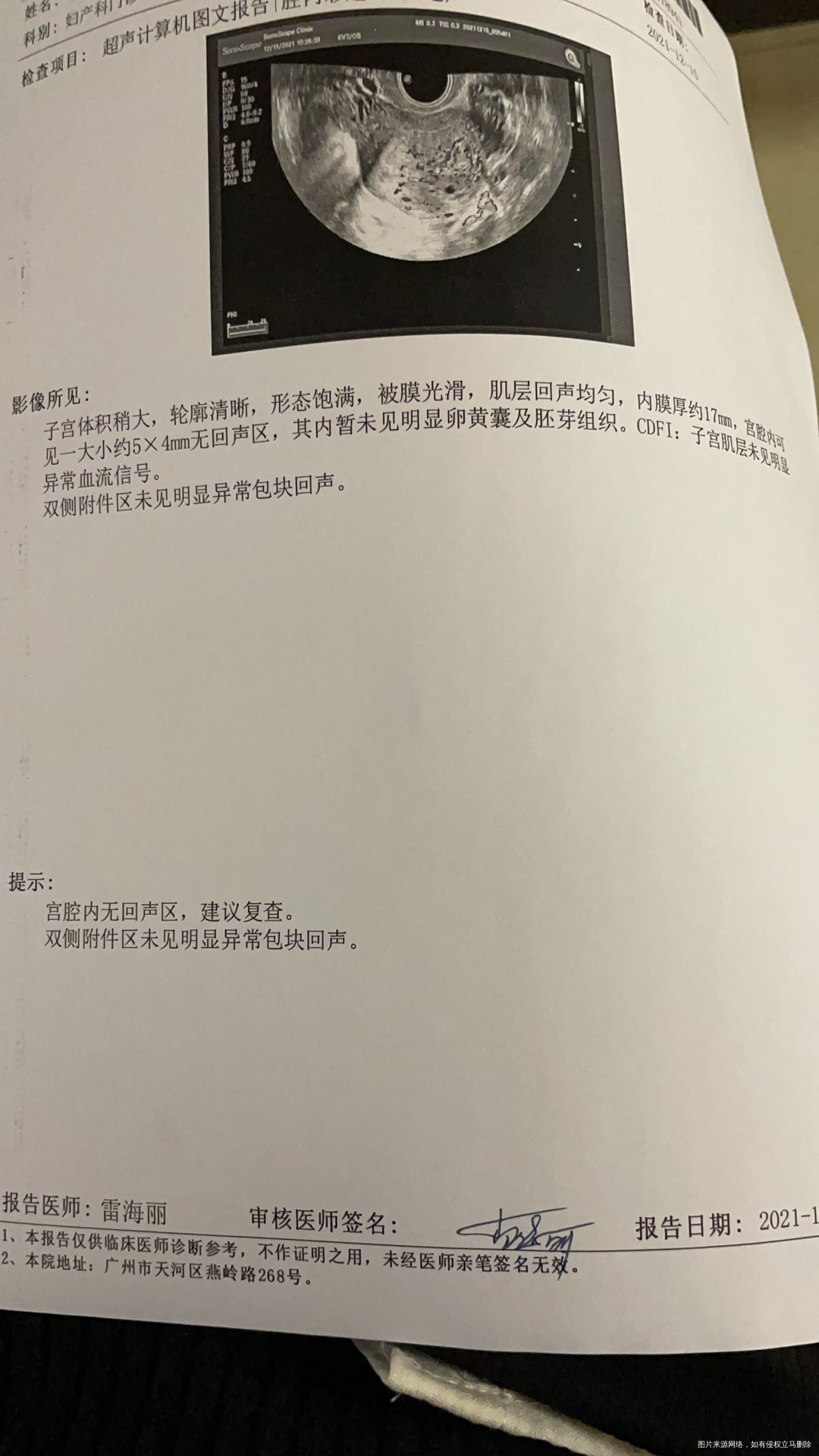 这个情况能进行保胎吗hcg翻倍慢末次月经10