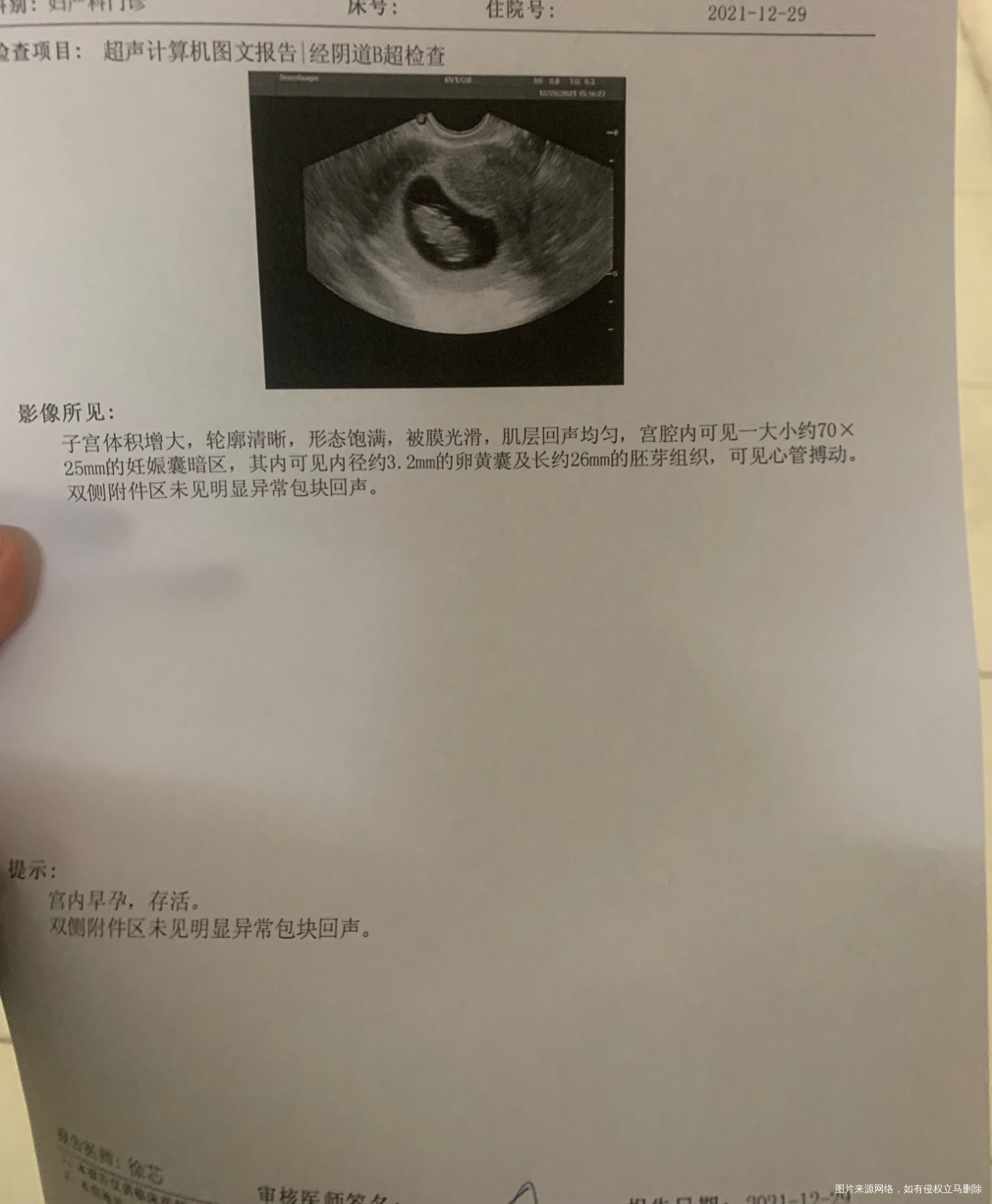 末次1025胚芽26mm是孕几周几天呢有点大