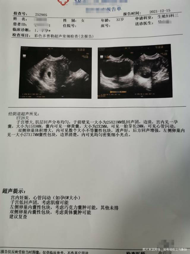 移植28天的B超医生说宝宝很弱让继续努力保胎