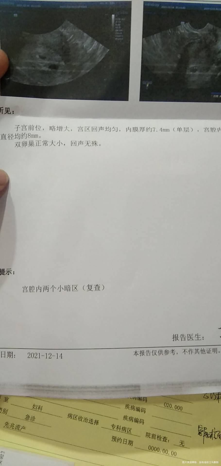 有点出血移植20天18天的时候做的B超
