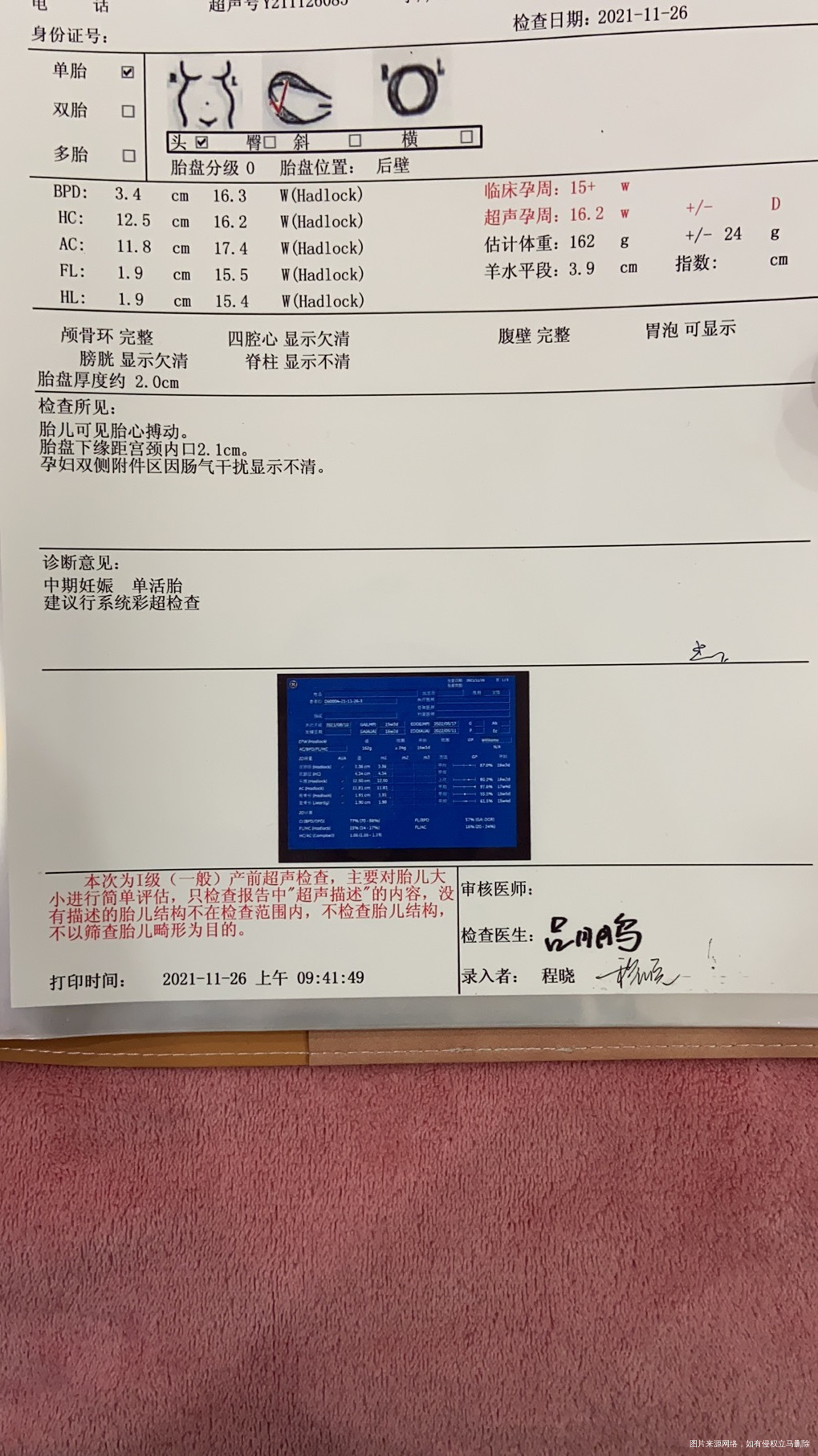 麻烦帮忙看看胎儿发育情况