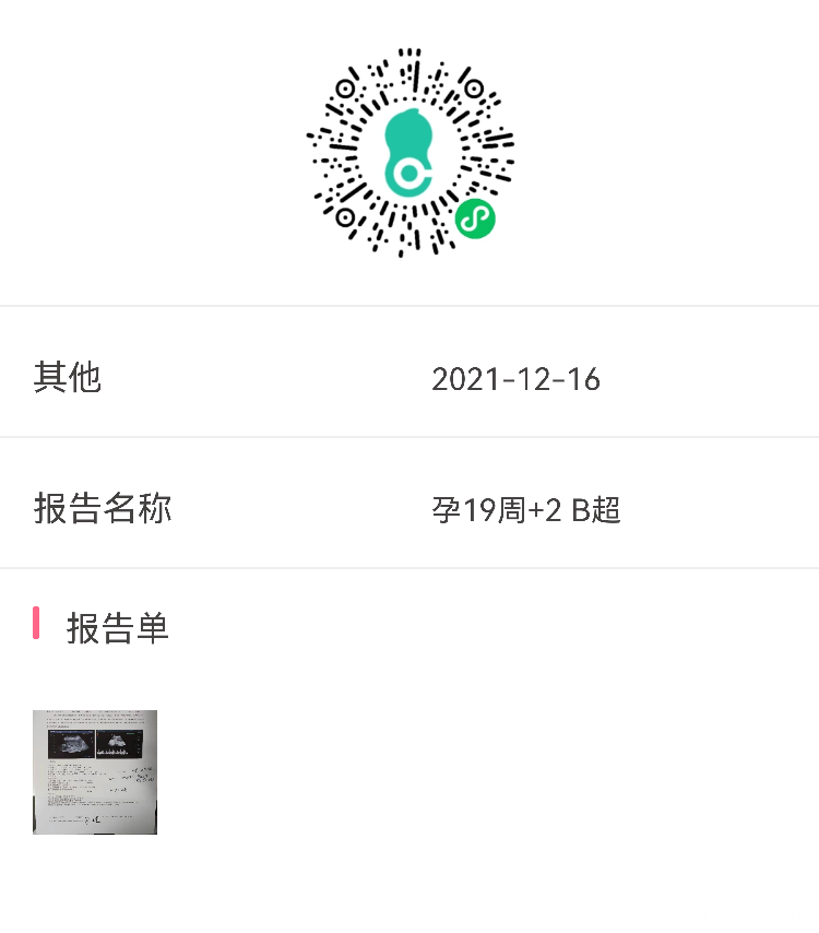 孕19周+21胎儿左肾集合系统分离09cm2