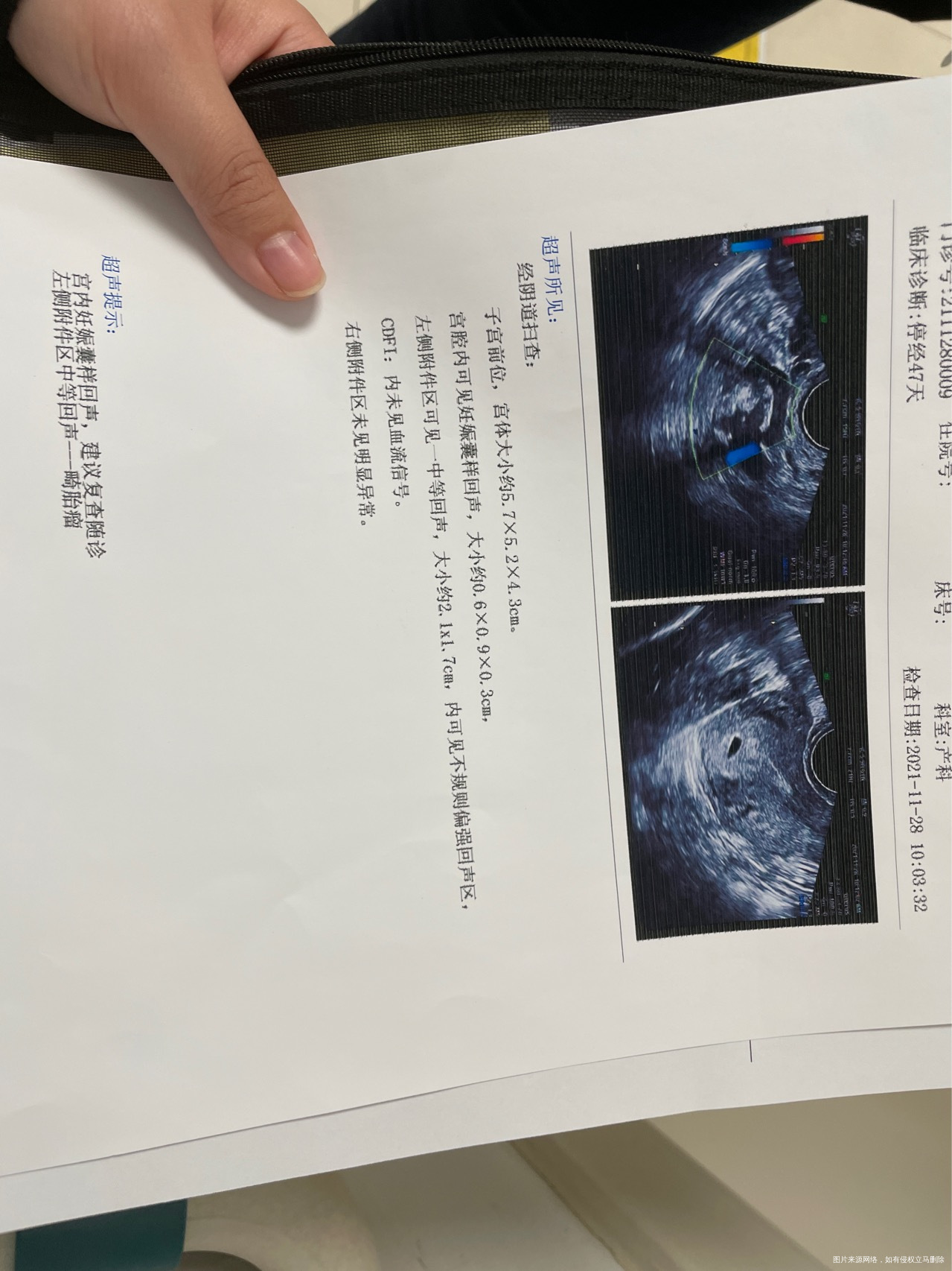 末次月经1012号每次月经3440天来一次发