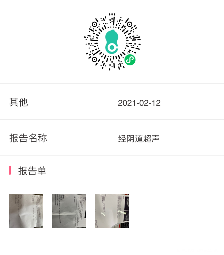 这是8号10号12号做的超声这个卵泡能成熟吗
