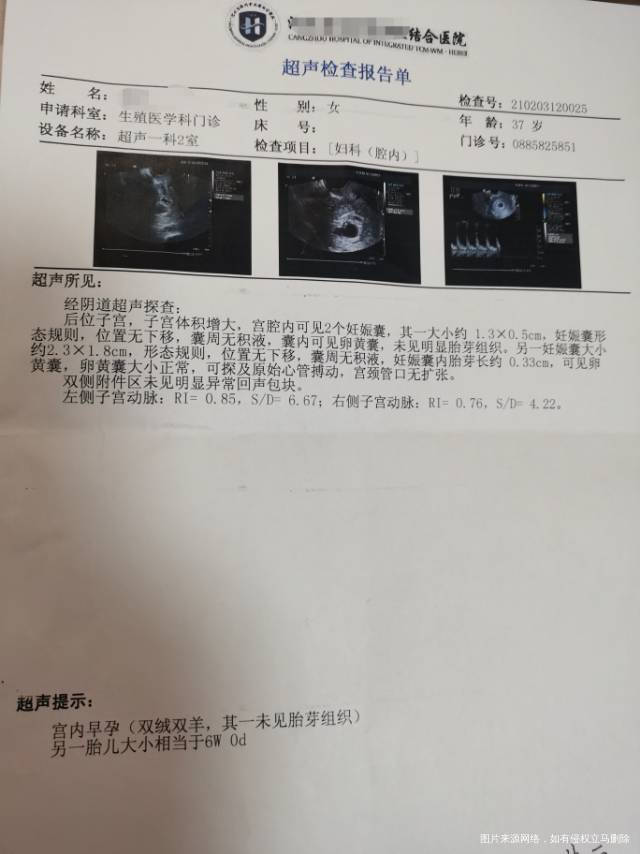 2月3号冻胚移植27天做的检查我这隔了4天突