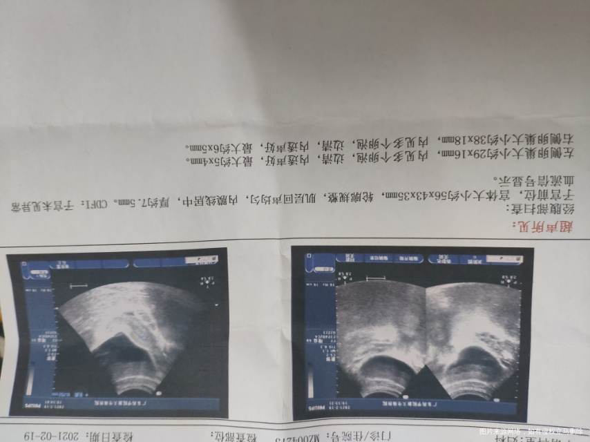 医生您好这是昨天来月经第三天去医院做的检查之