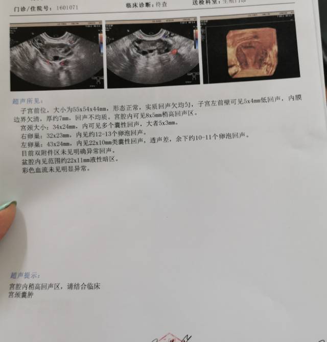 月经每次都正常来三十天左右一次来一次六天左右