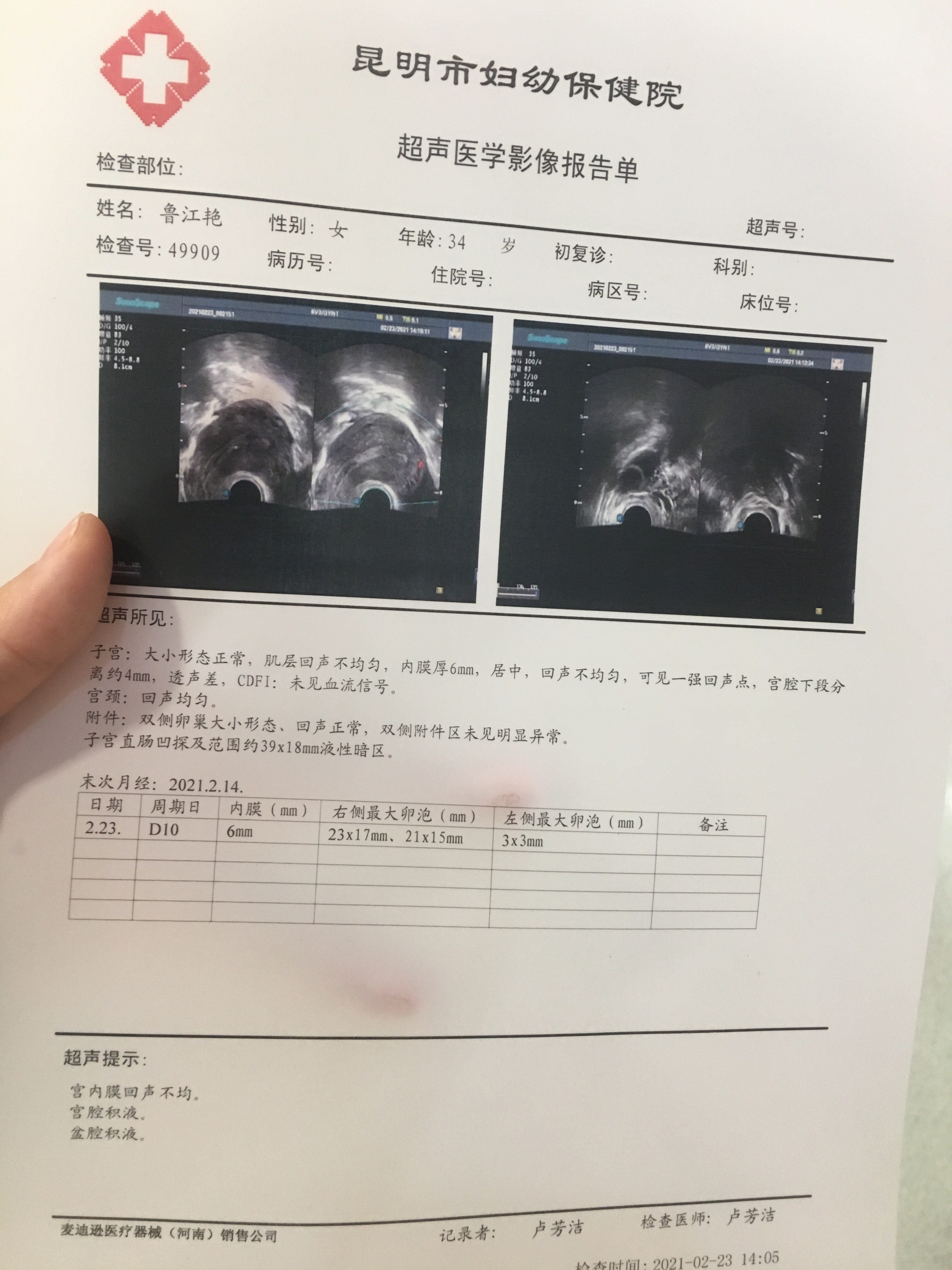 产后两个月子宫内膜回声不均可见一强回声点宫腔