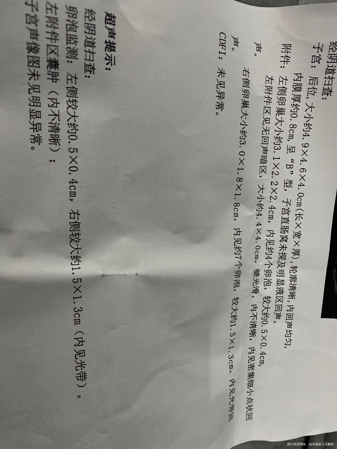 这是8号10号12号做的超声这个卵泡能成熟吗