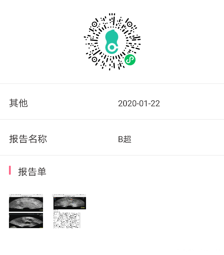 这是宫外孕保守治疗后3个月复查B超突然发现卵