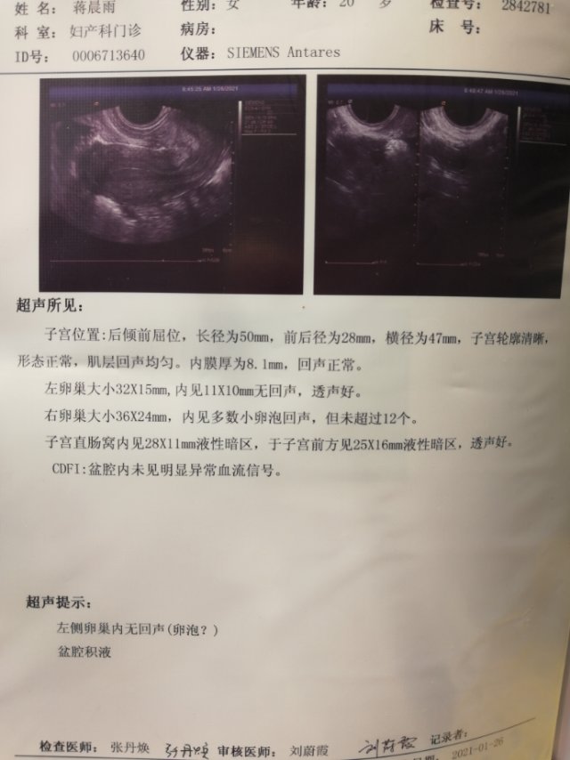 医生我的月经量从一年前开始减少检查结果显示孕