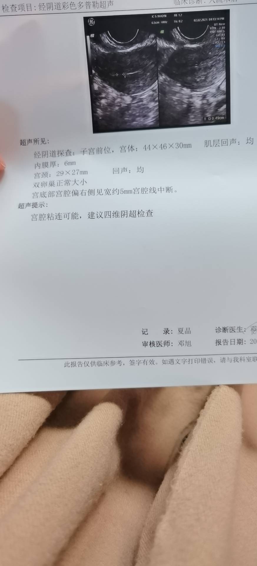 医生你好我2020年12月7日做了人流清宫手