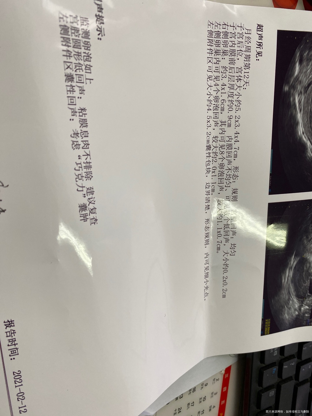 这是8号10号12号做的超声这个卵泡能成熟吗