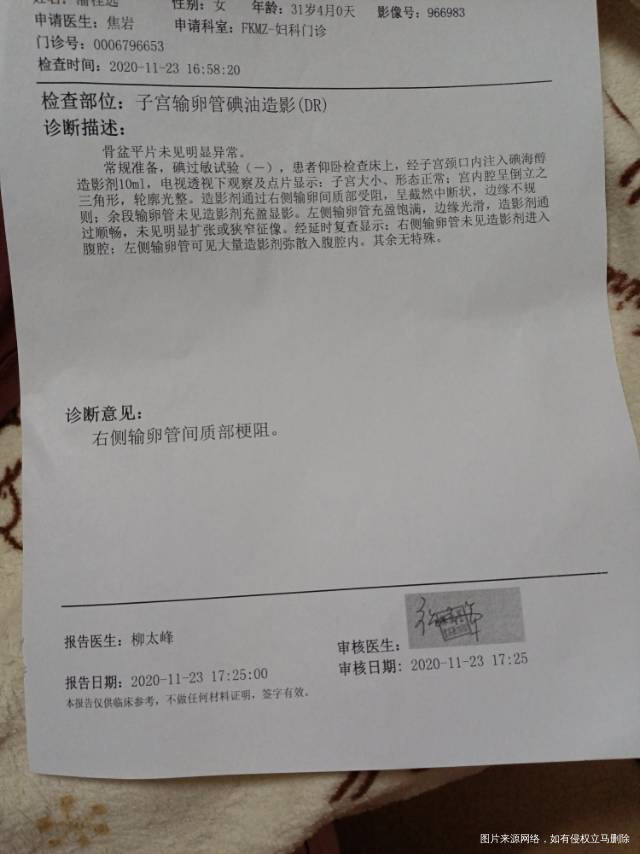 三年前宫外孕在这期间都没有备孕