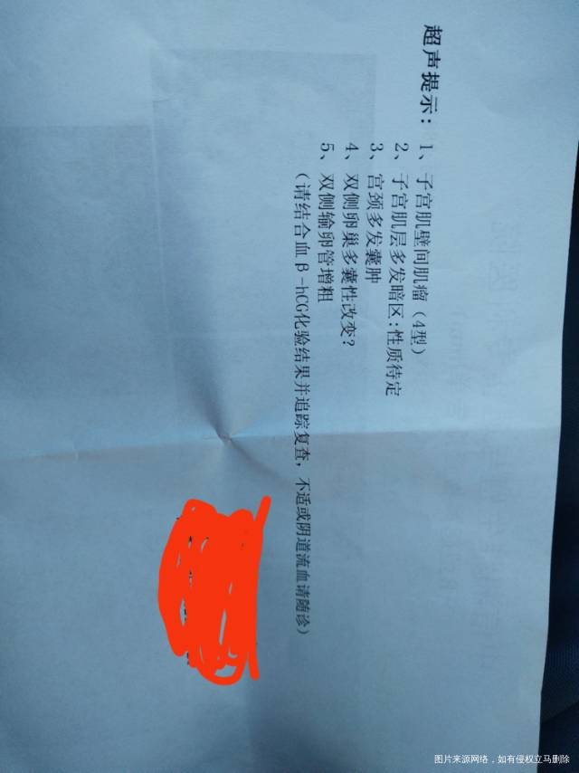 请问这个是什么情况孕酮降到了5hcg降到了1