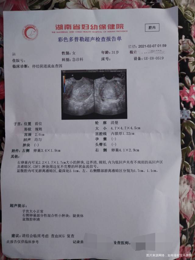 多囊卵巢患者12月28号的末次月经来曲唑促排