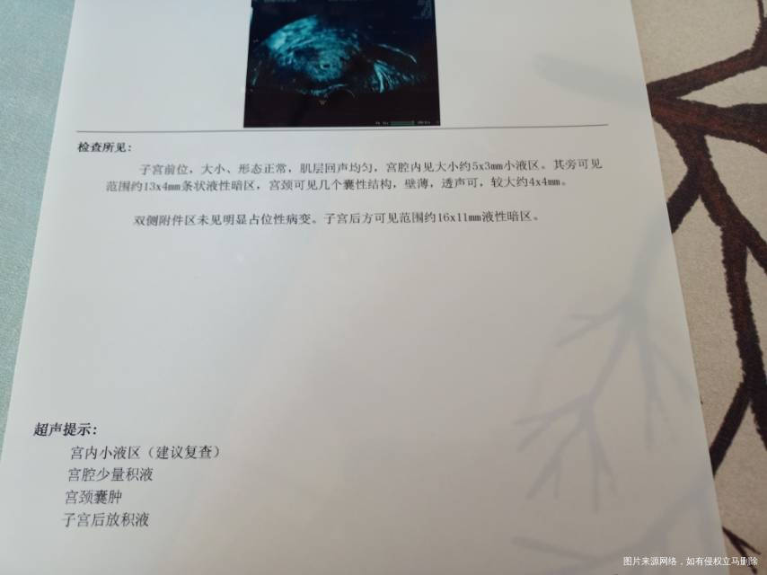 帮我看看我这个到底是怀孕了还是没怀呢第一次做