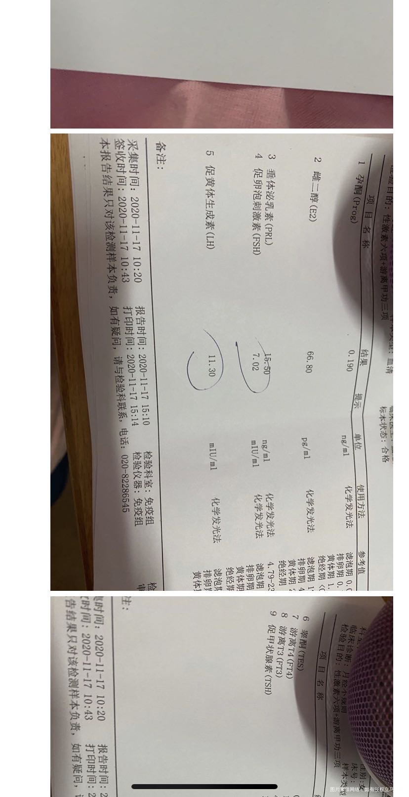 吃了达英3个月月经第二天去测激素第一张图片是