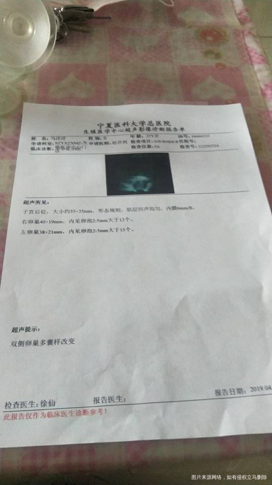 有多囊怎么才能好做过B超还有5项潋激素吃过中