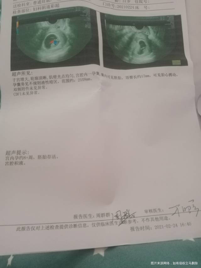 你好医生我现在怀孕两个月了之前一直有保胎吃着