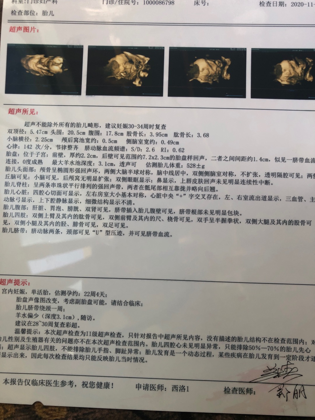 医生给你好想咨询下末次月经是525号停的但是