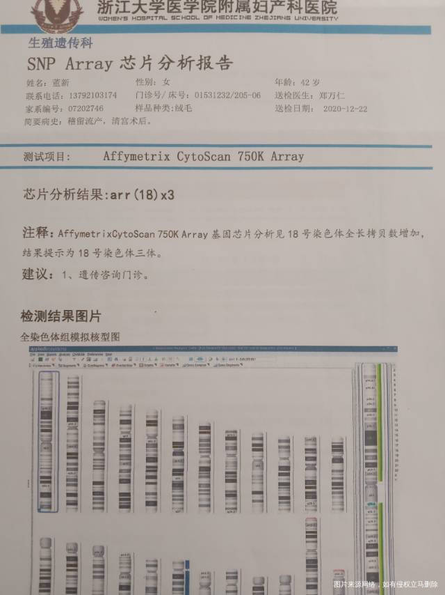 尊敬的医生您好我今年43岁我丈夫46岁201