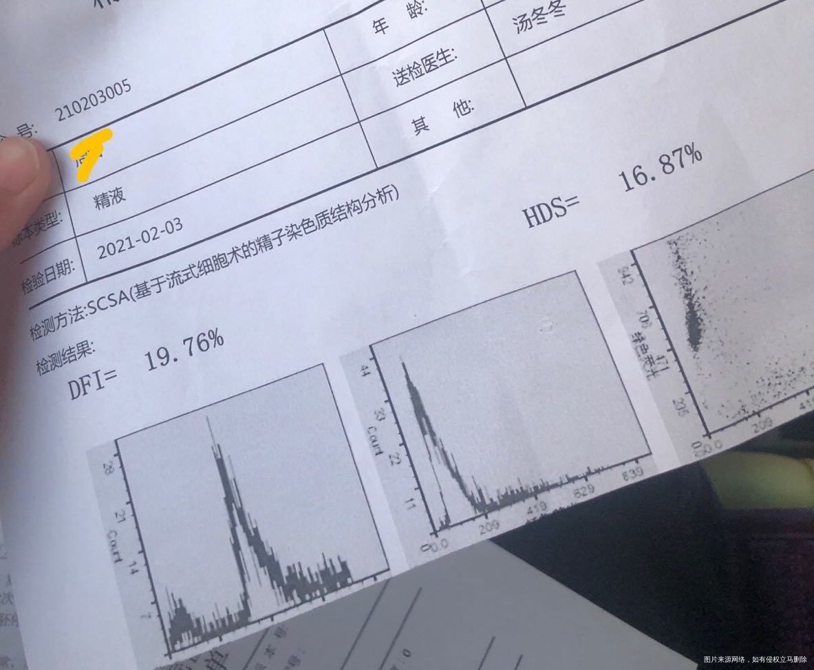 因胎停育两次所以去检查精子精子报告如下