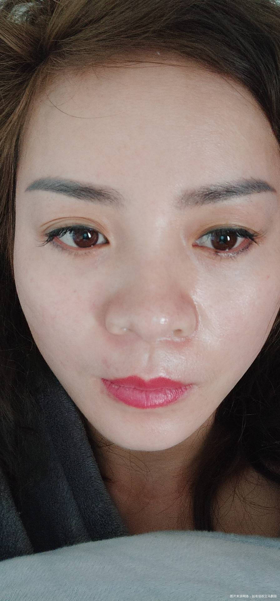 你好我今年38岁准备二胎之前做了个甲状腺癌手